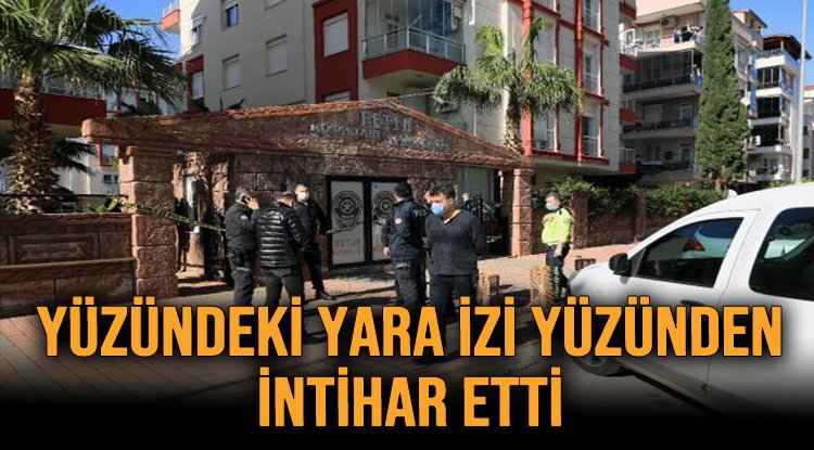 Yuzundeki Yara Izi Yuzunden Intihar Etti Lider Gazete Antalya Haber Ve Antalya Spor Son Dakika Haberleri
